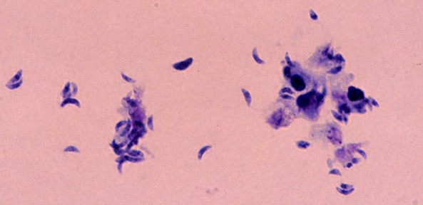 toxoplazma mycoplasma)