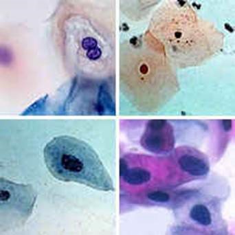 Микроскопия урогенитальных выделений у женщин